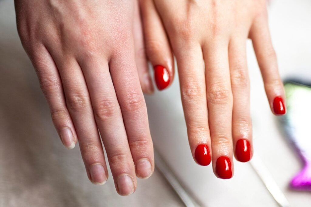 How To Treat an Allergic Reaction to Gel Nail Polish